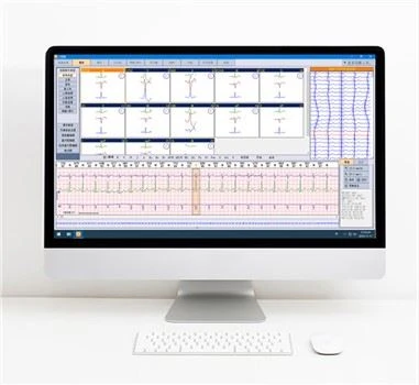 Dinaminė EKG Holterio analizės sistema